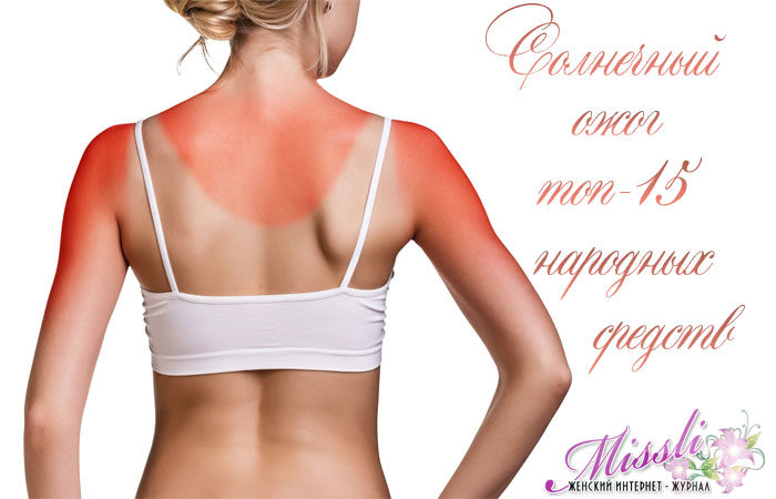 чем лечить солнечные ожоги в домашних условиях,проблемы кожи
